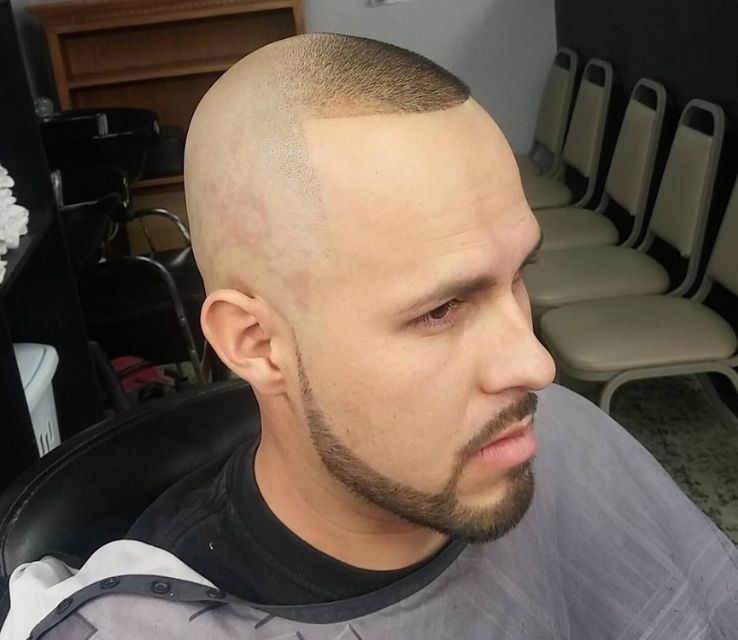 Bald Man with Chin Strap Beard