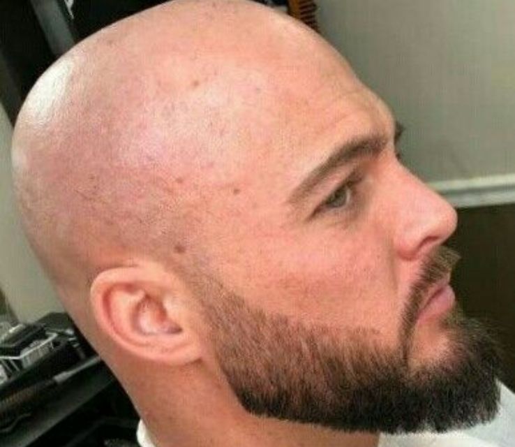 Short Boxed Beard with Bald Head